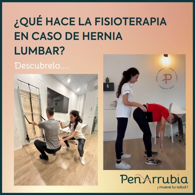 QU HACE LA FISIOTERAPIA EN CASO DE HERNIAS LUMBARES?